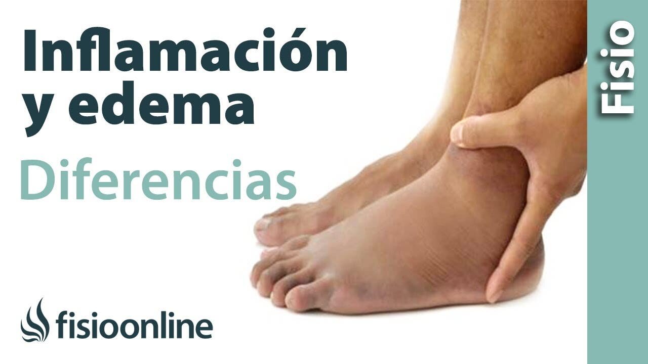Antiinflamatorios: Reduciendo la Hinchazón y el Edema