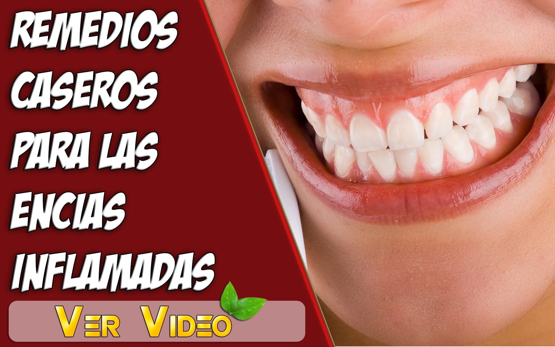 Cuidados en casa para encías inflamadas