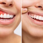 Dolor dental nocturno: causas, medicinas recomendadas y tratamientos dentales efectivos