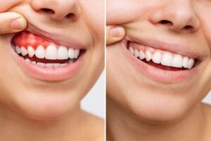 Dolor dental nocturno: causas, medicinas recomendadas y tratamientos dentales efectivos