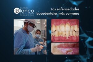 Enfermedades dentales comunes: síntomas, tratamientos y métodos de prevención más útiles