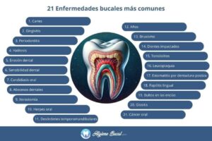 Enfermedades dentales hereditarias: diagnóstico temprano, tratamientos y medicinas recomendadas