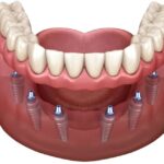 Guía completa sobre tratamientos dentales de emergencia y medicinas más utilizadas en odontología