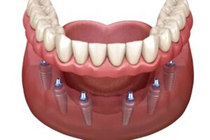 Guía completa sobre tratamientos dentales de emergencia y medicinas más utilizadas en odontología