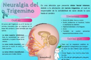 Medicamentos más recomendados para neuralgia del trigémino dental y tratamientos complementarios