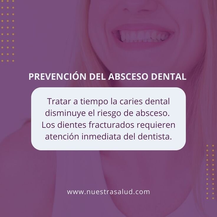Medicamentos para Tratar Abscesos Dentales