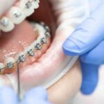 Medicinas más efectivas tras ortodoncia y cuidados posteriores en odontología