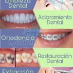 Medicinas para controlar sangrado tras cirugía dental y tratamientos odontológicos de apoyo