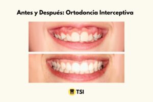 Medicinas para prevenir infecciones tras ortodoncia y cuidados esenciales