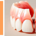 Medicinas para reducir dolor tras colocación de prótesis dentales y cuidados de recuperación