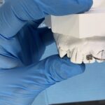 Ortodoncia moderna: tratamientos dentales innovadores, cuidados y medicinas necesarias