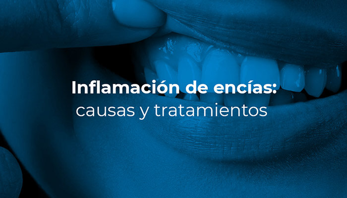 ¿Por qué se produce la inflamación después del tratamiento periodontal?