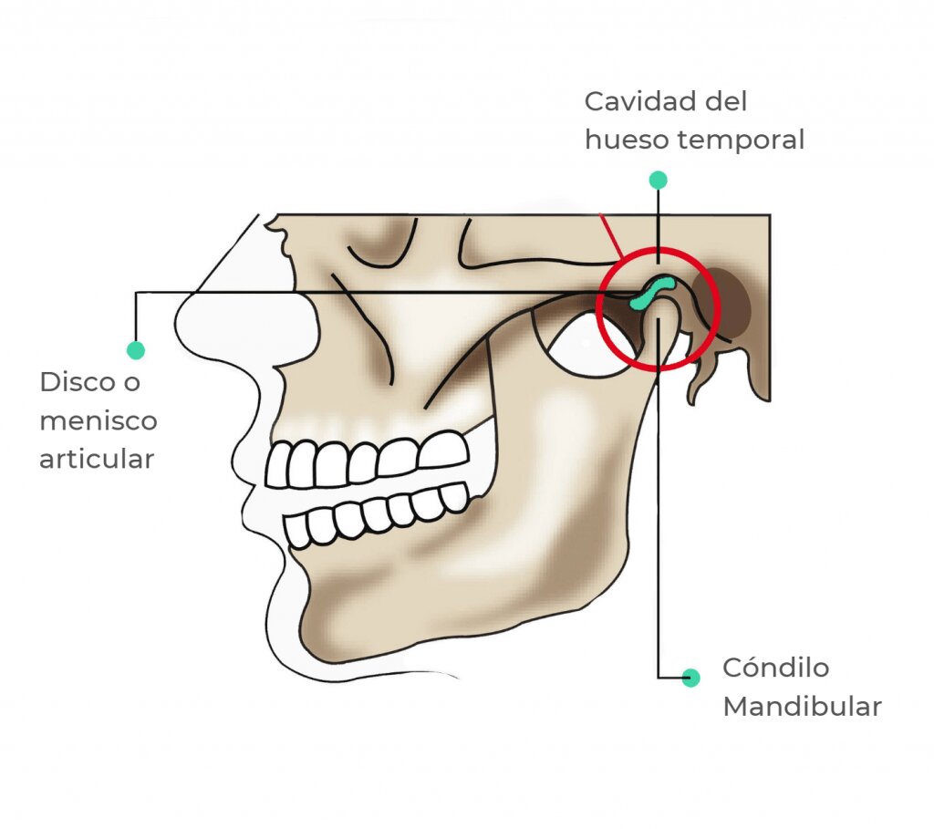 Problemas de la Articulación Temporomandibular (ATM)