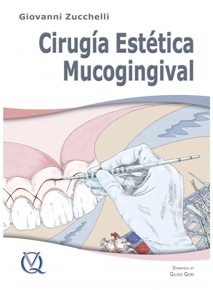 ¿Qué es la Cirugía Estética de Encías?