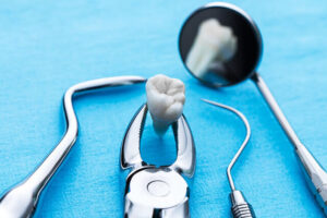 Tratamiento dental de urgencia en niños: medicinas recomendadas y cuidados posteriores esenciales