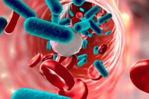 Tratamiento dental integral contra infecciones recurrentes y medicinas recomendadas