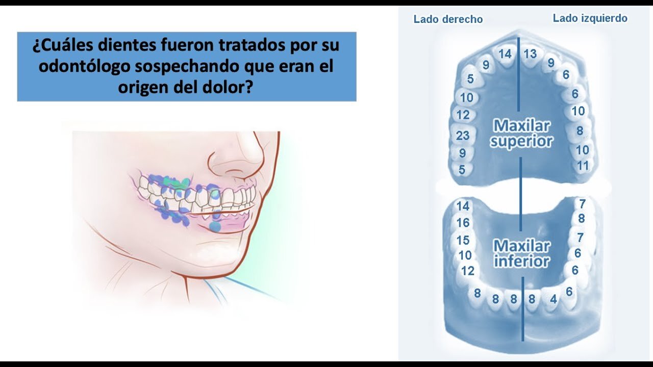Tratamientos complementarios para la neuralgia del trigémino dental