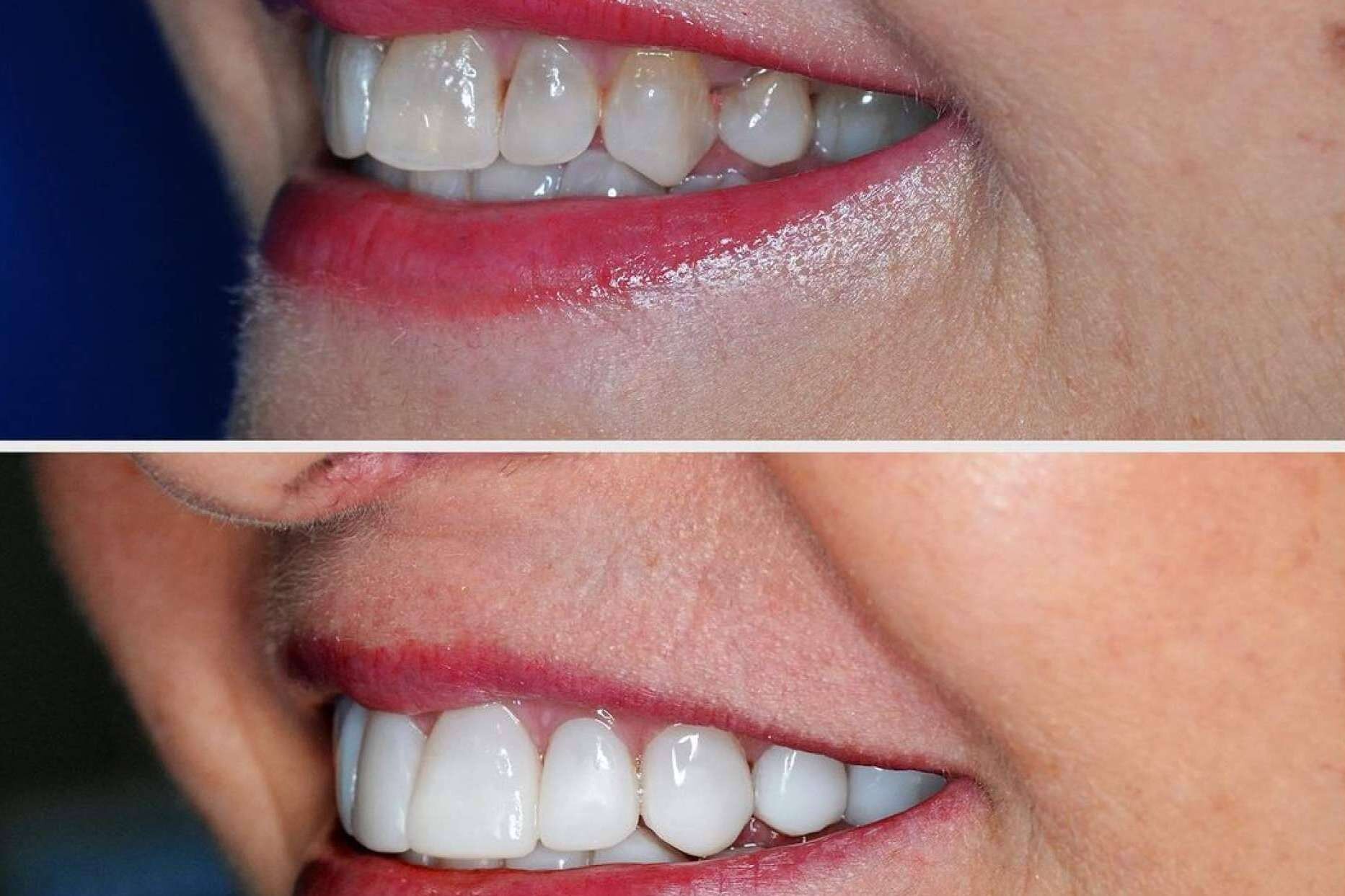 Tratamientos de Estética Dental de Vanguardia