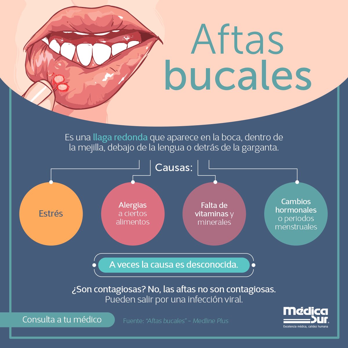 Tratamientos Dentales Actuales para Aftas Bucales