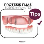 Tratamientos dentales con prótesis fijas y medicinas recomendadas para recuperación segura