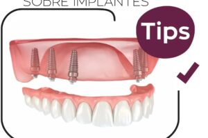 Tratamientos dentales con prótesis fijas y medicinas recomendadas para recuperación segura