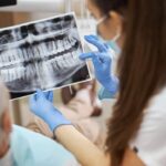 Tratamientos dentales contra la pérdida de hueso maxilar y medicinas utilizadas en la recuperación