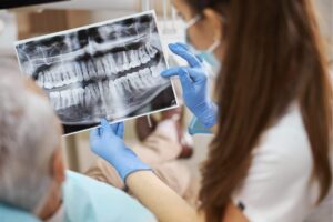 Tratamientos dentales contra la pérdida de hueso maxilar y medicinas utilizadas en la recuperación