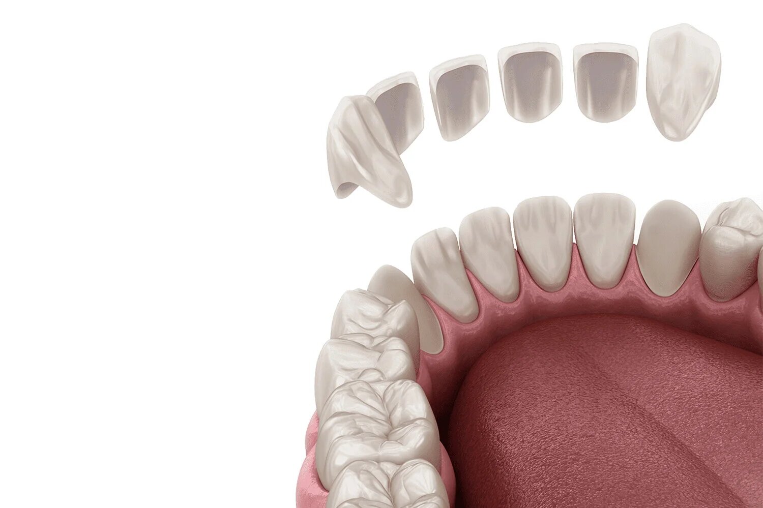 Tratamientos Dentales Estéticos Populares