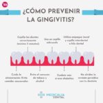 Tratamientos dentales más efectivos para combatir la gingivitis y recuperar tu salud oral
