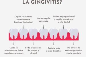 Tratamientos dentales más efectivos para combatir la gingivitis y recuperar tu salud oral