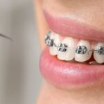 Tratamientos dentales para corregir problemas de mordida y medicinas necesarias