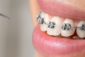 Tratamientos dentales para corregir problemas de mordida y medicinas necesarias