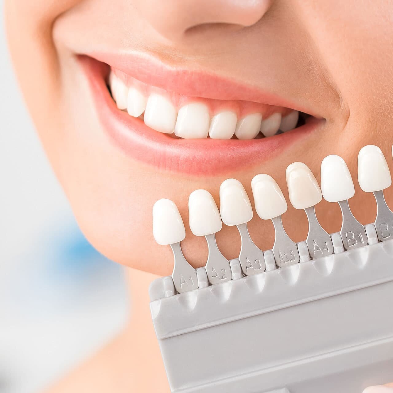 Tratamientos dentales recomendados