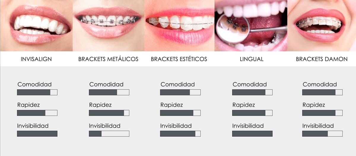 Tratamientos dentales recomendados
